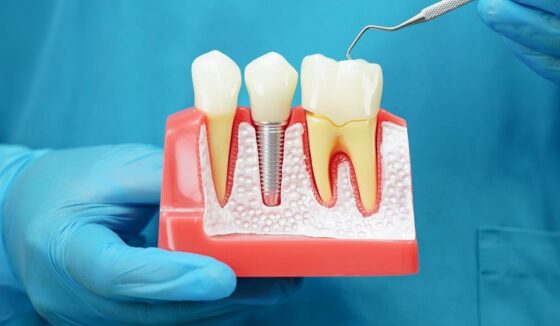 ARCHIMED to acquire life sciences company ZimVie for 0m