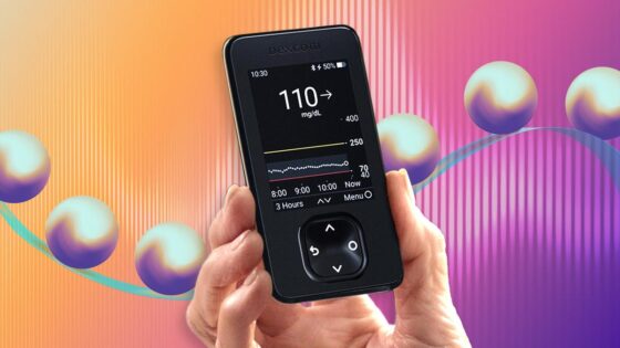 The Dexcom Continuous Glucose Monitor Receiver Recall: What You Need to Do to Stay Safe